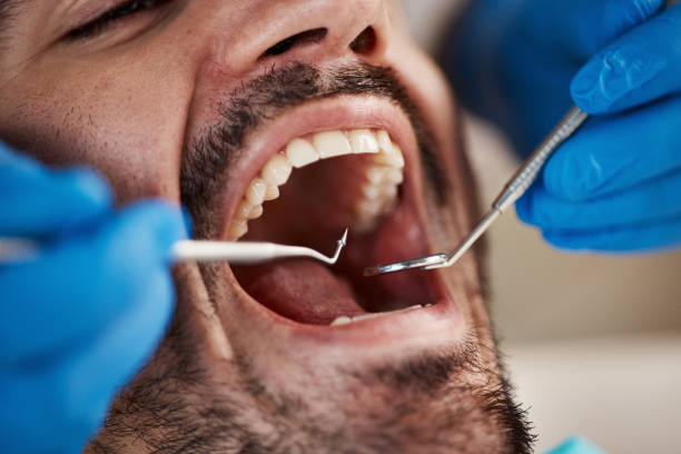 Best Emergency Dental Surgery in New Lebanon, OH